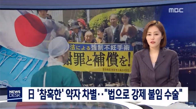 日 ‘참혹한’ 약자 차별…“법으로 강제 불임 수술” 2019년 4월 28일에 보도된 MBC 뉴스데스크 영상 캡처. 