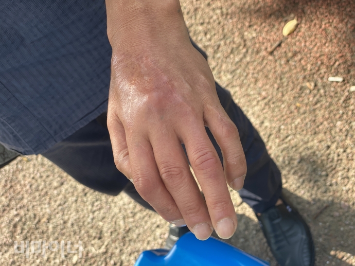 김재순의 아버지 김무영(가명)의 손. 아들과 마찬가지로 김무영은 2002년, 제재소에서 일하던 중 분쇄기에 걸린 나무를 빼내려다 왼쪽 손이 끼어 돌아가는 산재사고를 당해 손에 장애를 입게 됐다. 사진 이가연