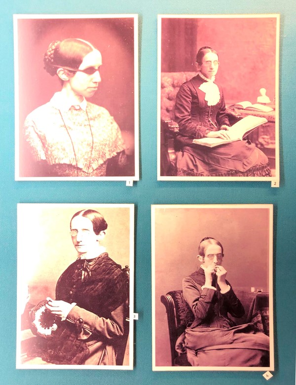 퍼킨스맹인학교에 전시되어 있는 로라 브리지먼의 사진 ⓒ김승섭