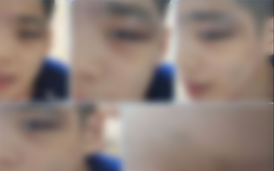 성락원에 거주하는 학대 피해자의 눈과 얼굴 곳곳에 멍과 상처투성이가 있다. 사진 제공 성락원대책위