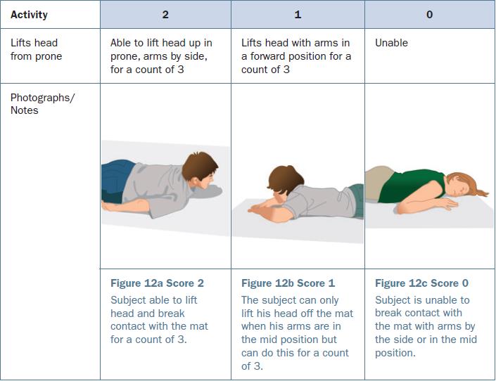 평가 도구인 HFMSE에 따르면 0점은 주로 일정 동작을 할 수 없으며, 1점은 3초 동안 일정 동작을 유지해야 하며, 2점은 3초 이상 일정 동작을 유지해야 한다. 심평원이 추진하는 대로 기준이 강화되면 이 점수를 4개월마다 올려야 한다. 사진 출처 HFMSE Manual of Procedures and Score Sheets, Biogen